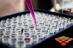 Остеопонтин, N-термінальний фрагмент, (миша), ІФА JP27259 фото